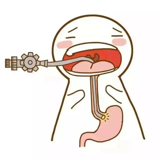 胶囊胃镜检查前后的注意事项,胃镜检查前后的注意事项课件