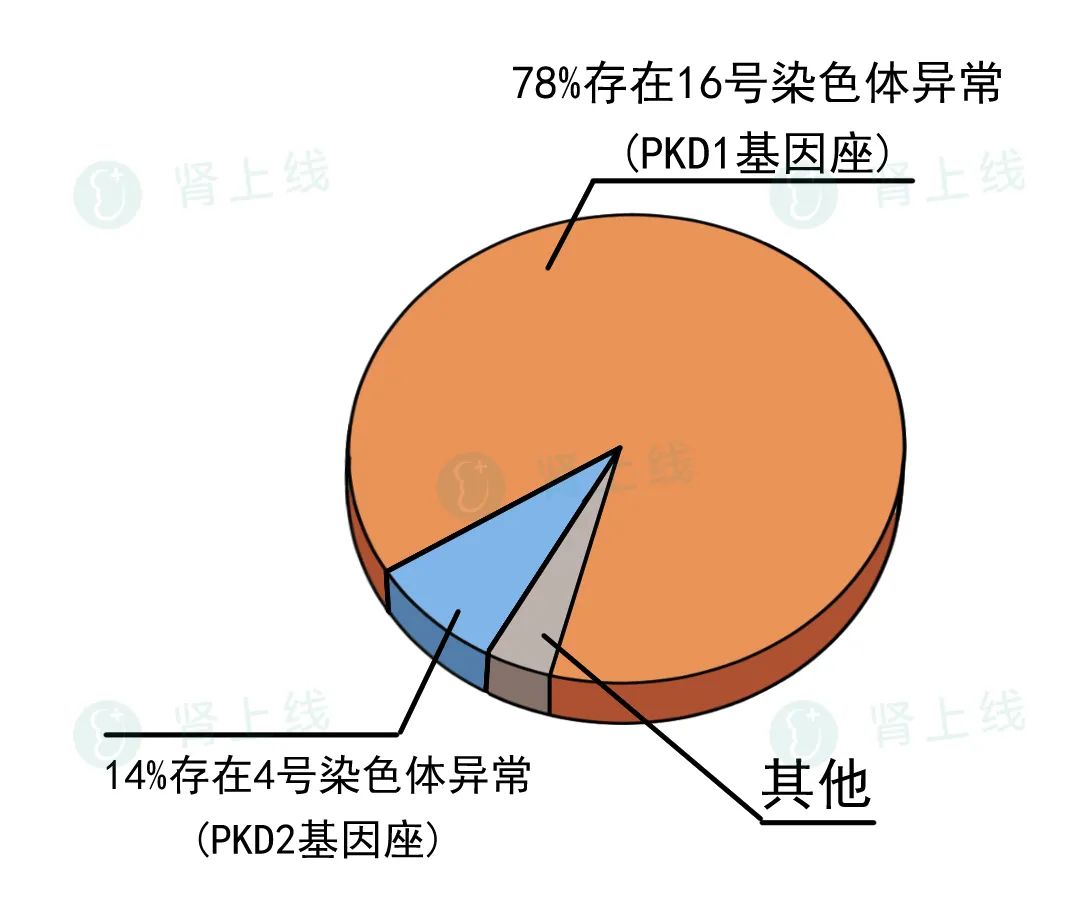 一家接连患尿毒症，是怎么回事？了解最常见的遗传性肾病-多囊肾
