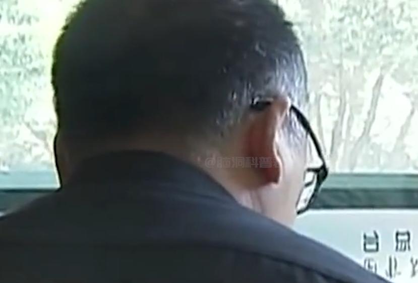 割包皮的真实体验,三种割包皮手术哪一种比较好