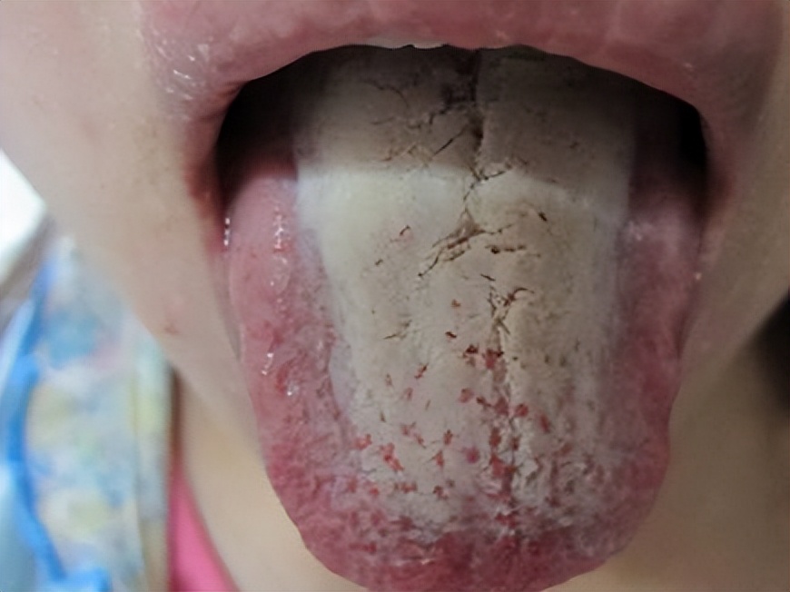 晚上睡觉经常醒？醒后入睡困难？医生告诉你原因，教你绝招搞定它