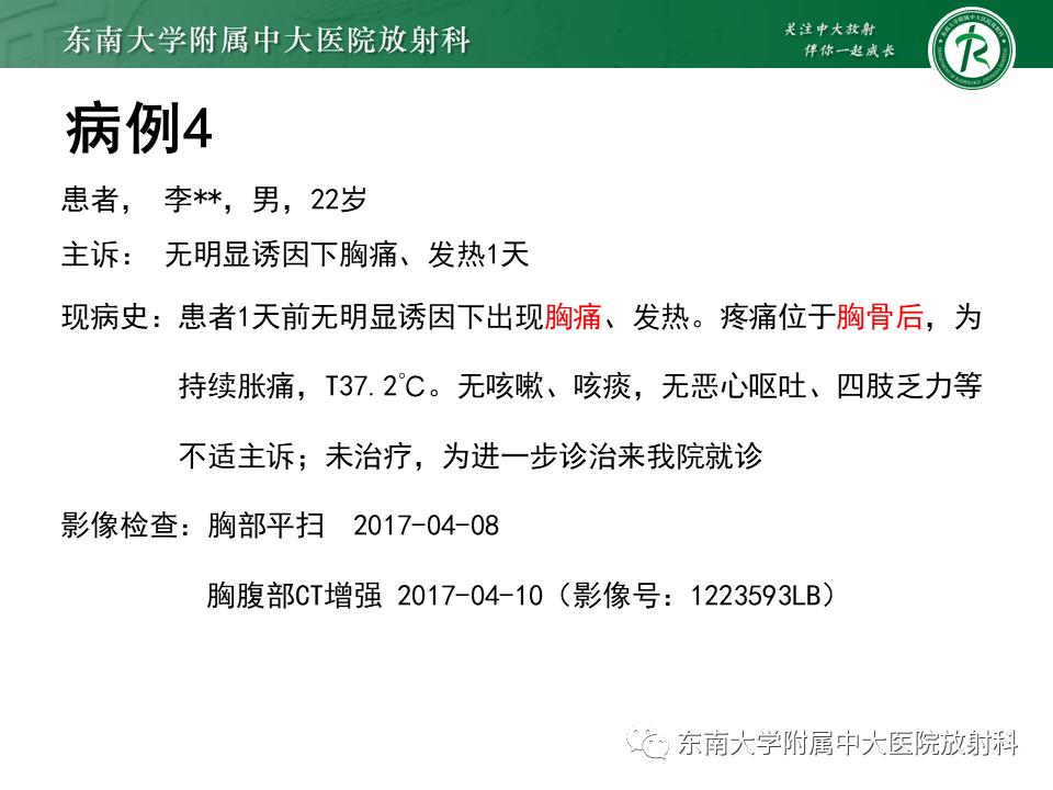 好文分享值得深思,纵隔精原细胞瘤