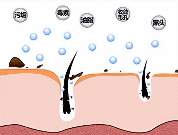 女生毛孔粗大有黑头用哪款面膜,清洁面膜推荐祛黑头收缩毛孔平价