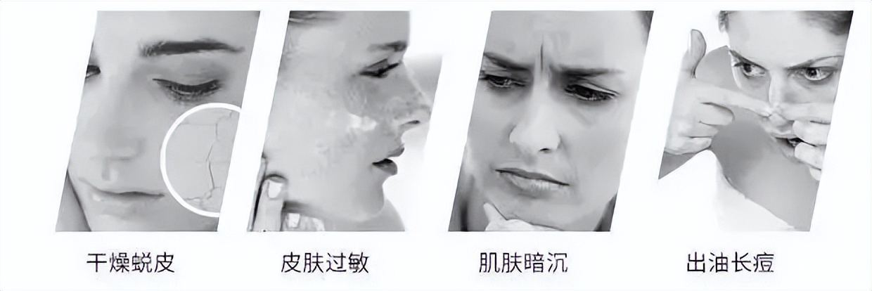 脸起皮干燥紧绷刺痛发红？这四个原因才是造成敏感肌的罪魁祸首