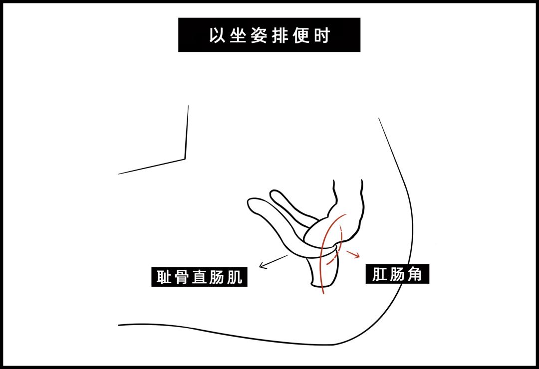 被公厕水溅到会得淋病吗,被公厕水溅到会感染吗