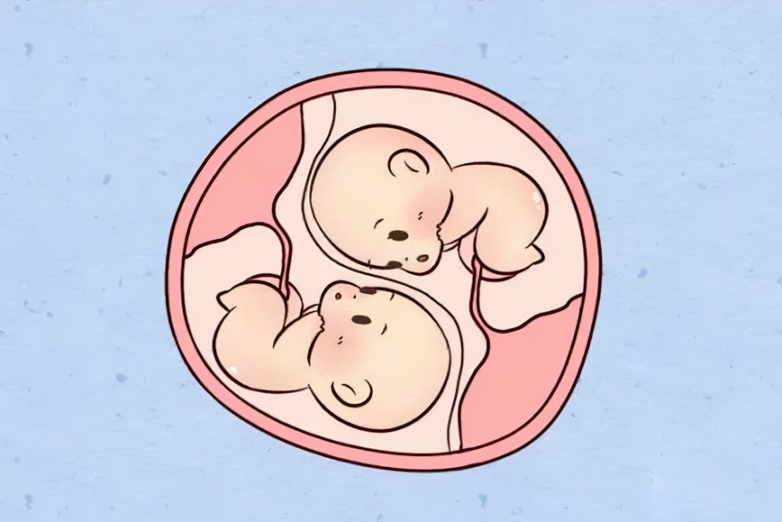 如何正确认识唐筛,唐筛第一项