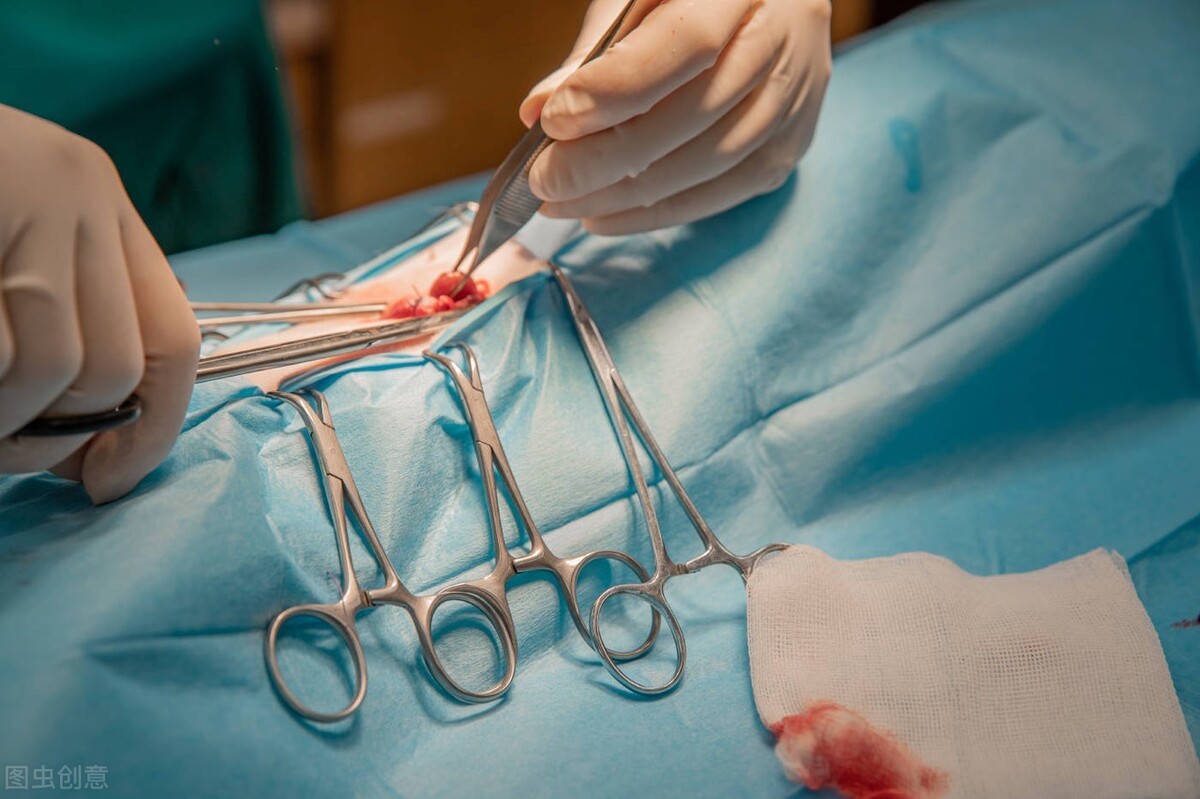 女性结扎好还是男性结扎伤害小,女人结扎和男人结扎后遗症