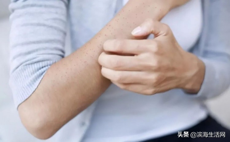 三个月宝宝甲醛中毒反应,甲醛中毒眼睛会有反应