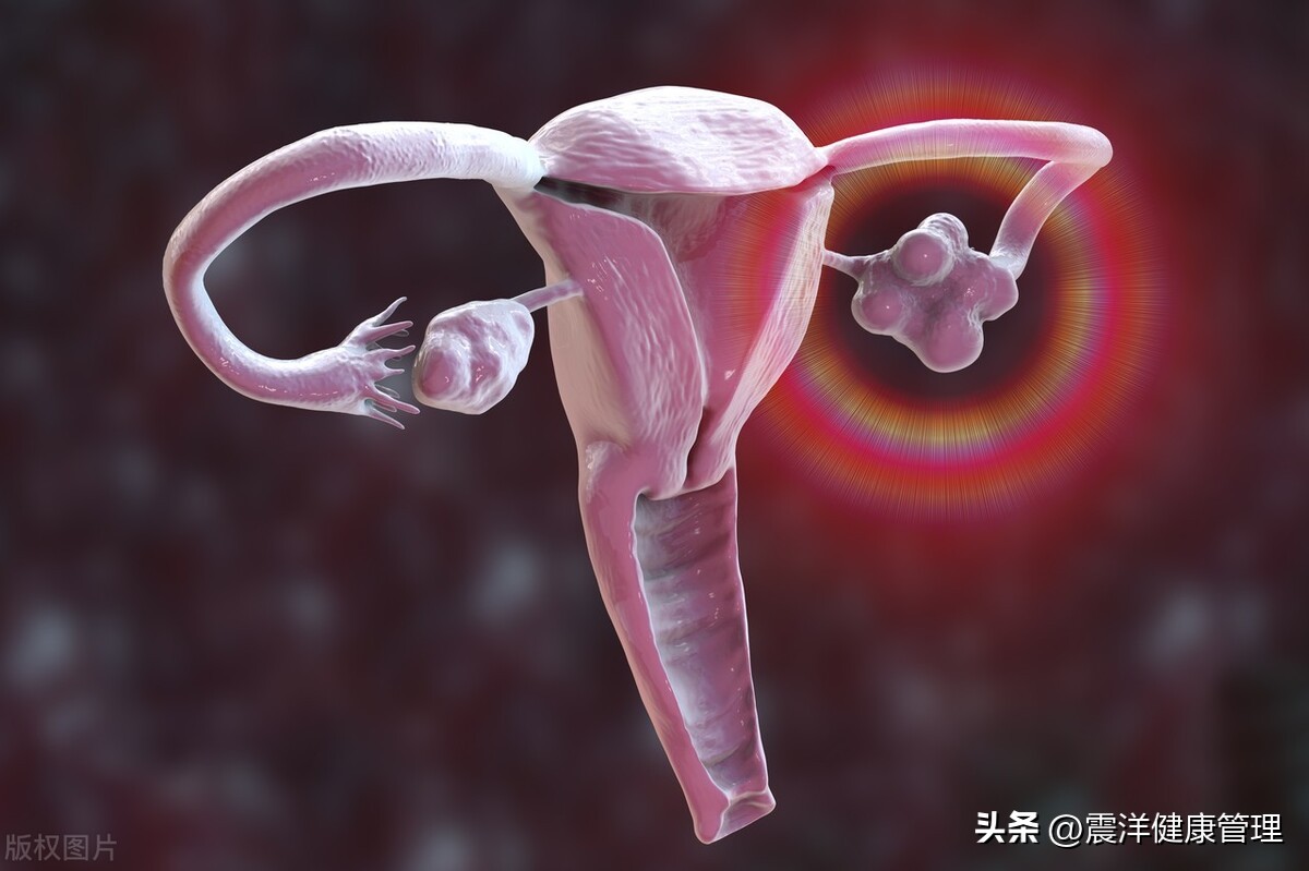 女性4种疼痛小心妇科疾病,女性三种疼痛是妇科病