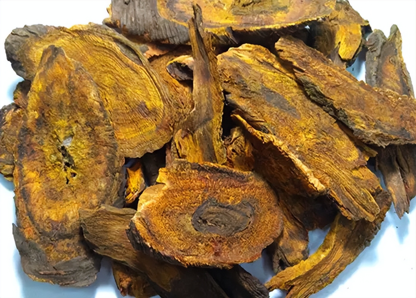 中医认为肛门瘙痒症的发病原因是什么？有何治疗建议？