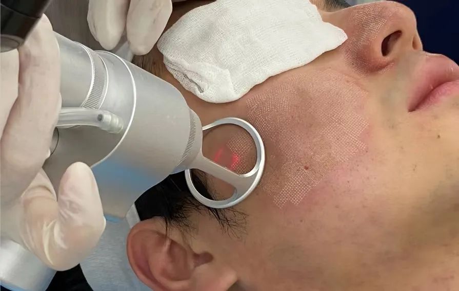 受伤后千万不要抠结痂,受伤了希望不要留下疤痕