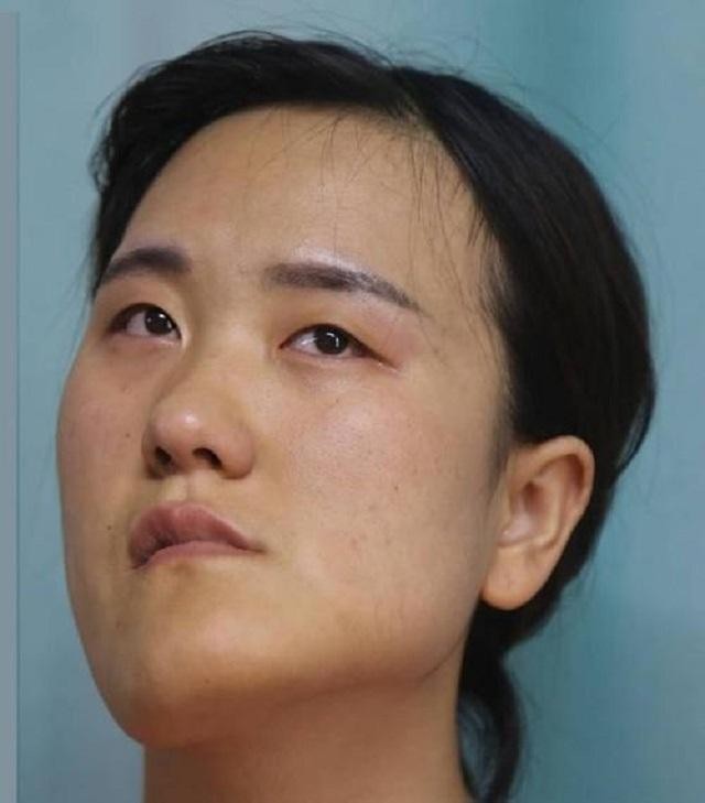 东北“歪脸”女孩整形成大美女，拒绝当网红，只想回山村当教师