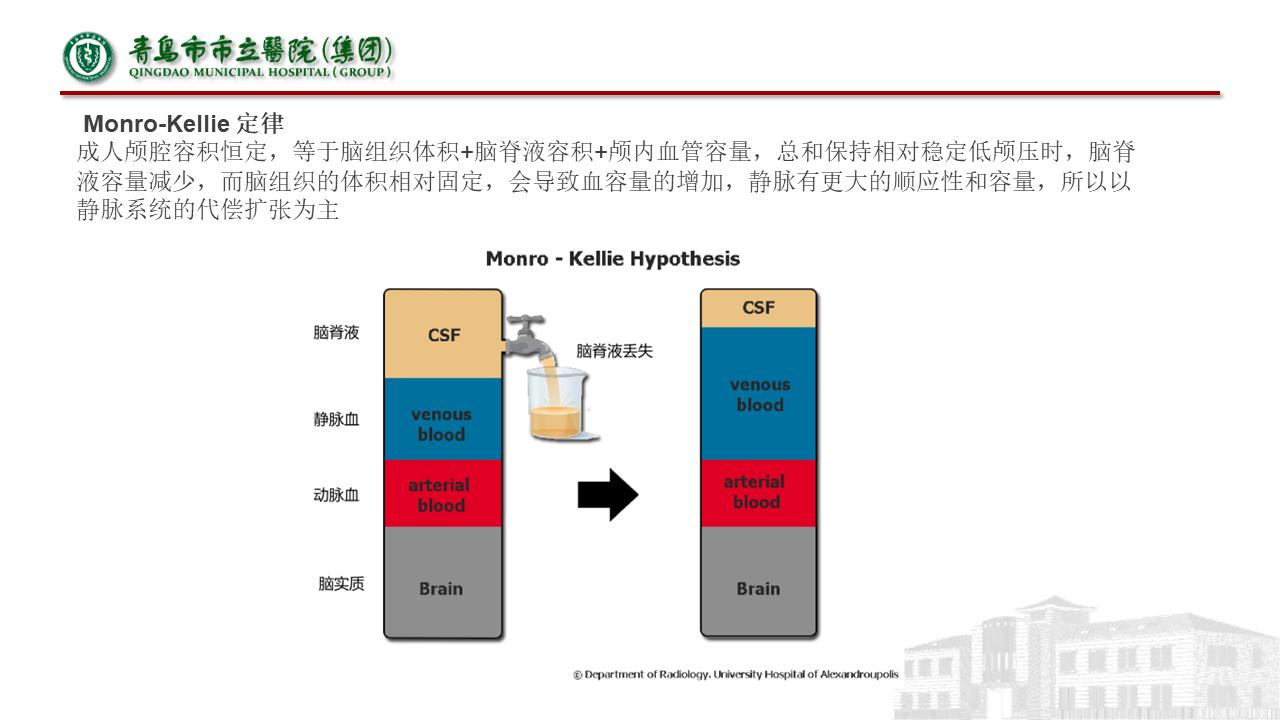 低颅压综合征耳闷,低颅压综合征吃什么药