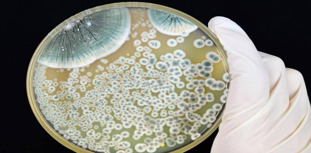 神医在世，亚历山大·弗莱明创造出神奇药，拯救了上万人的性命