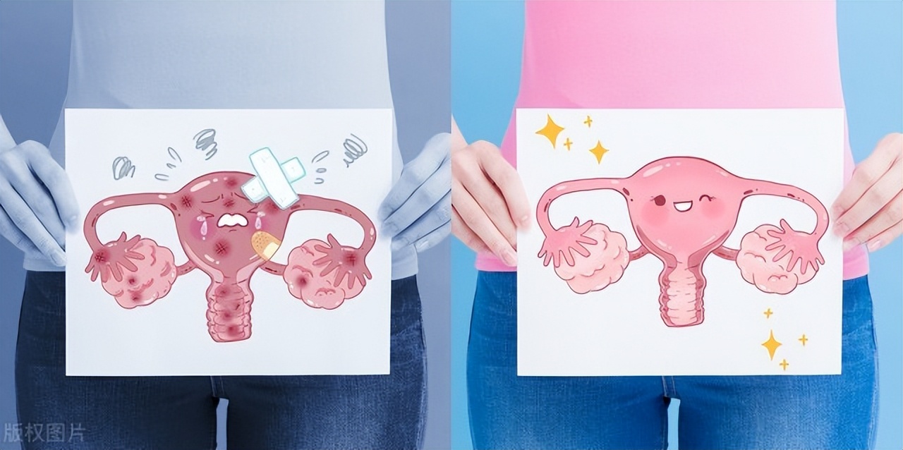 女性身体发臭异味白带褐色,女性有异味发臭正常吗