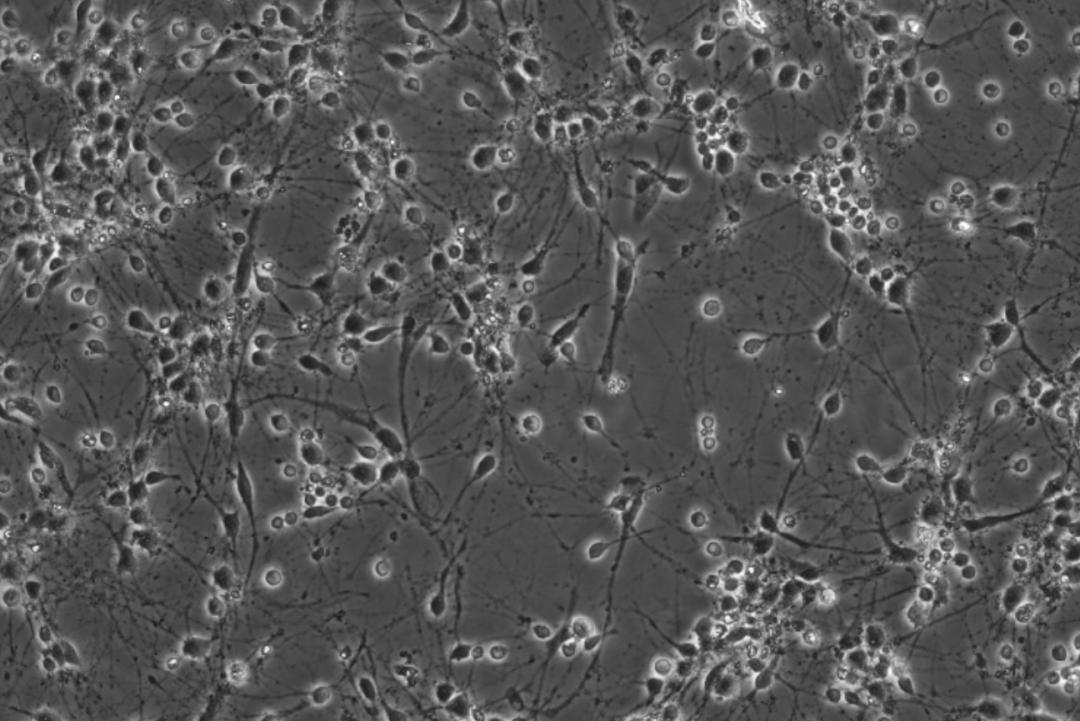 人类的大脑到底有多强大,人类的大脑是多少g的内存