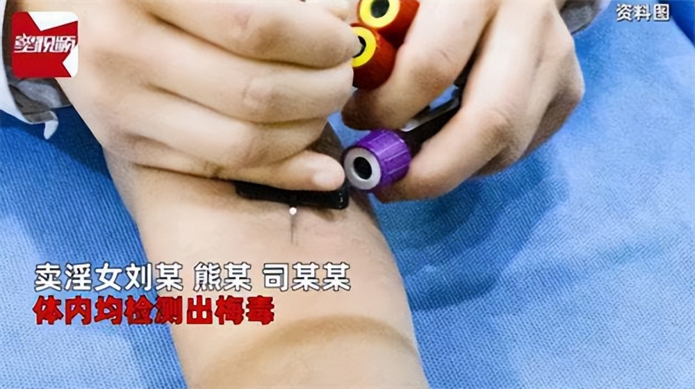 在家中招嫖，失足女还涉及3名梅毒患者，辽宁这桩旧案结果如何？