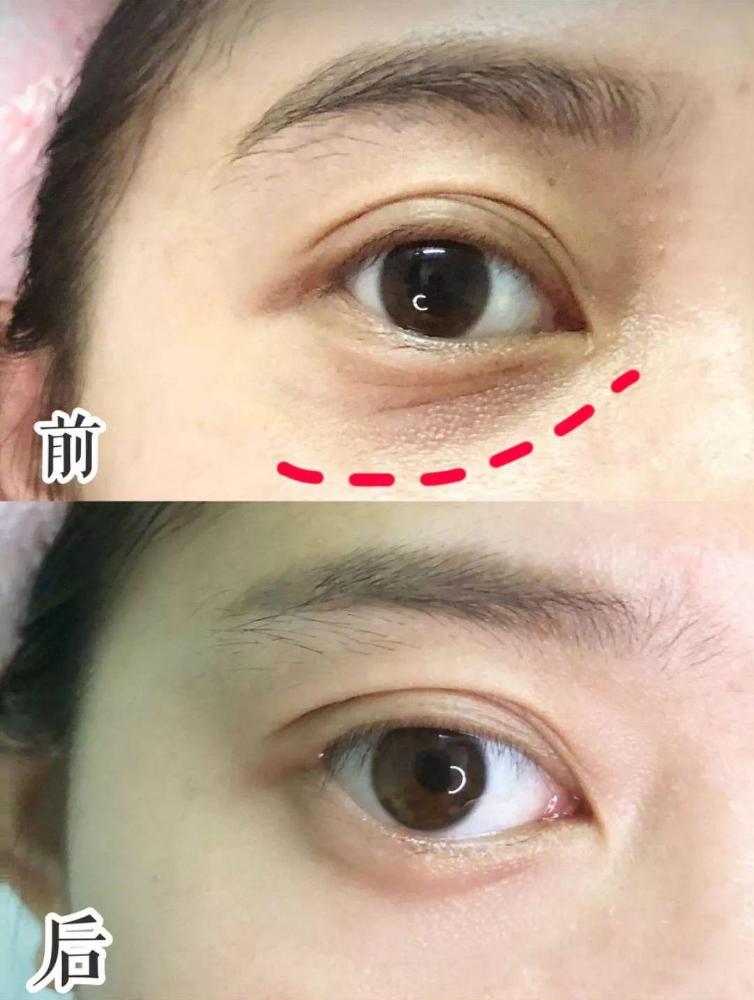 赫莲娜绿宝瓶和娇兰哪个更抗老,赫莲娜和海蓝之谜和娇兰哪个抗老