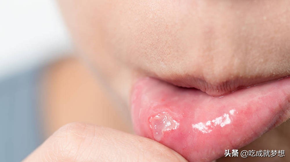 冬天枸杞和什么泡水不上火,一吃枸杞就上火怎么回事