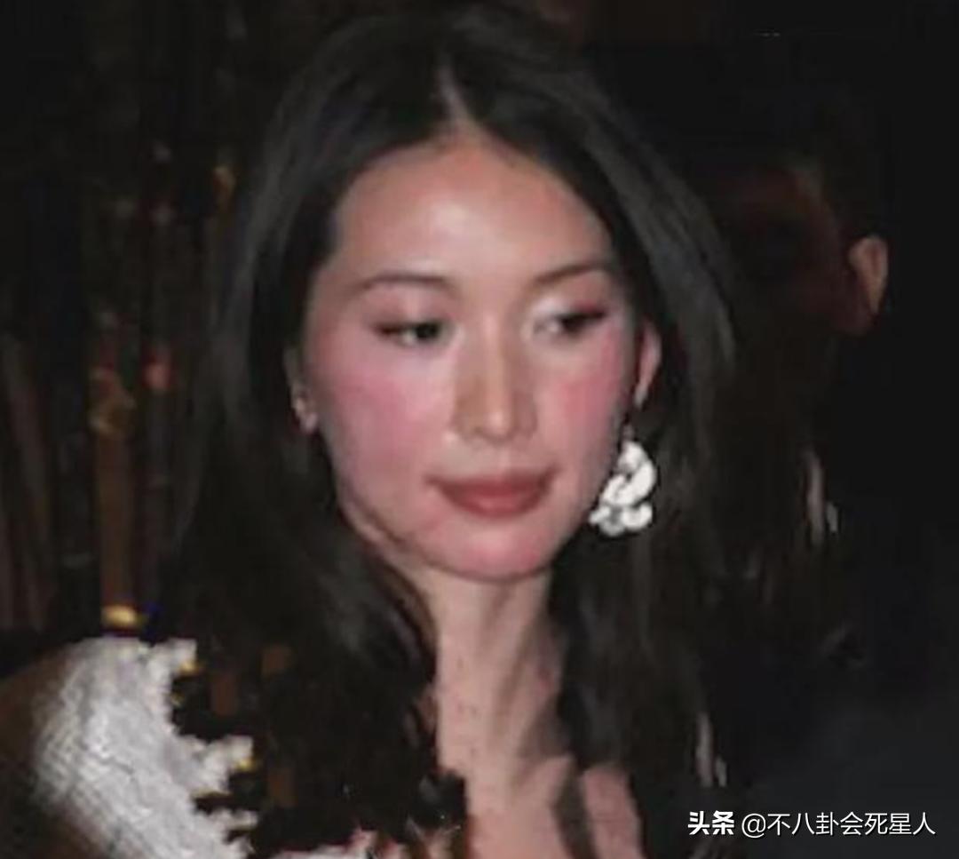 天生没子宫对口水过敏的明星,天生没子宫对口水过敏