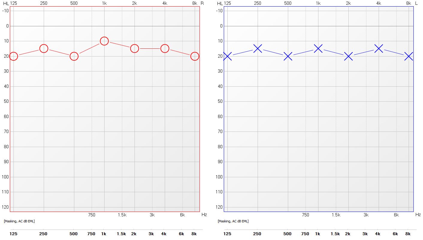 面肌痉挛耳后微创治疗,面肌痉挛外科微创诊治副作用