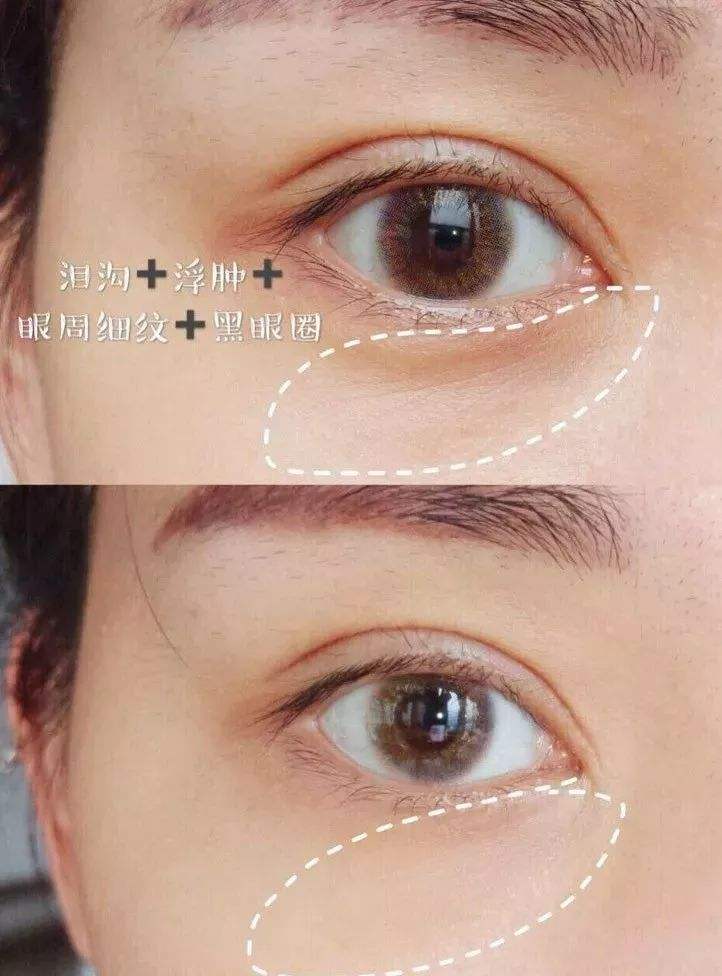 去细纹黑眼圈效果最好的眼霜,真正去细纹黑眼圈有效的眼霜