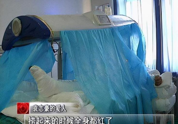 河南男子掉入油锅后来怎么样了,河南男子掉进油锅