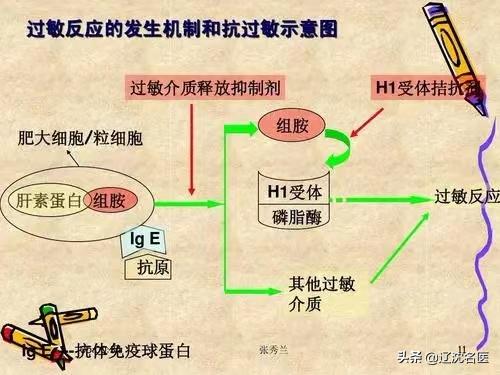 春季过敏性鼻炎结膜炎怎么治疗,过敏性结膜炎的高发季节注意事项