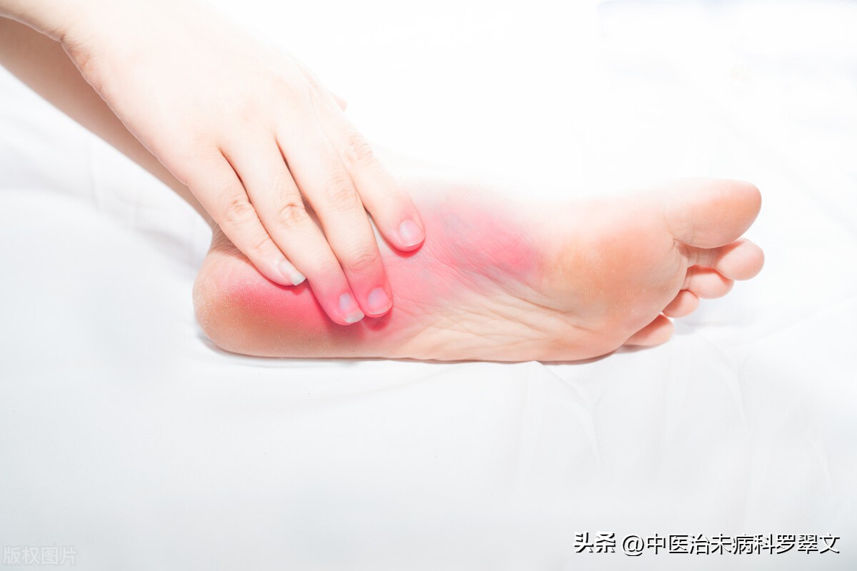 专家讲解痛风患者降尿酸药方案,任达然化浊祛瘀痛风汤