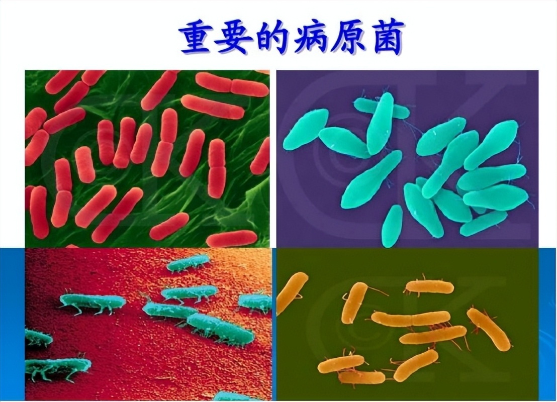 尿路感染最常见的致病菌有哪些,发生尿路感染最常见的感染途径是