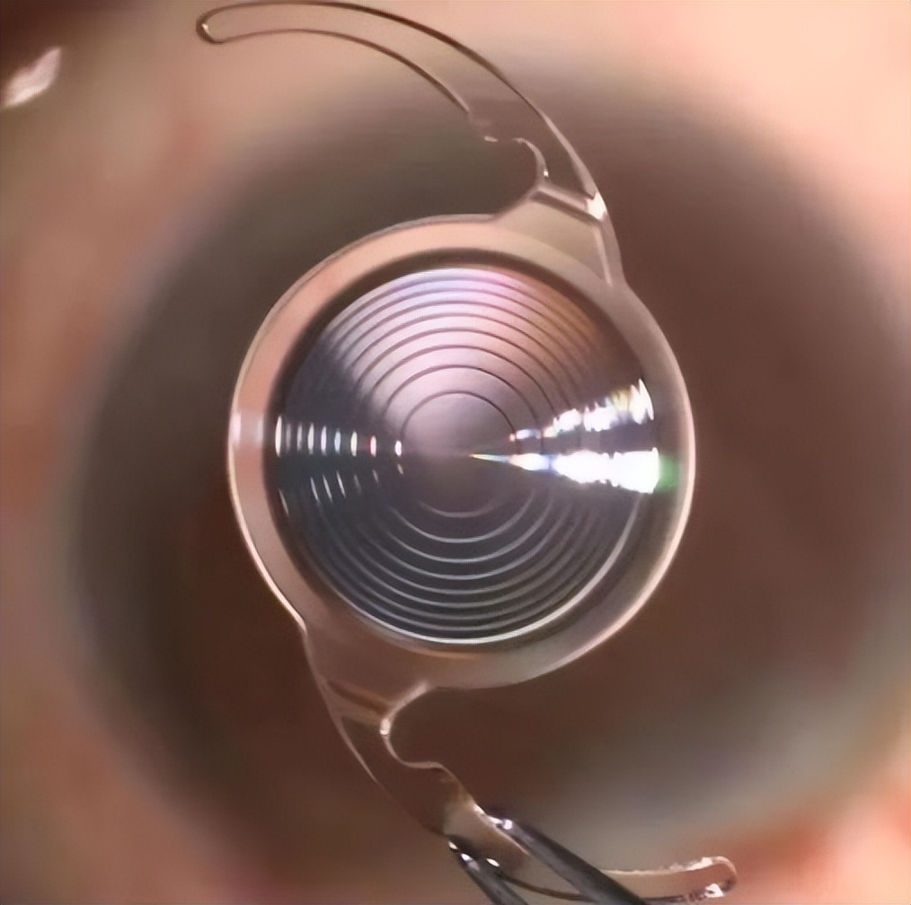 年纪大了看不清能戴老花镜吗,年纪大了看不见眼睛