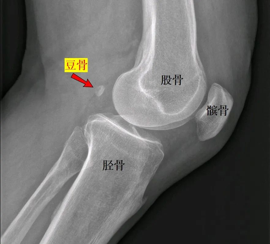 分享一些人类还在演化的好消息，比如我们正在失去智齿丨说点人事