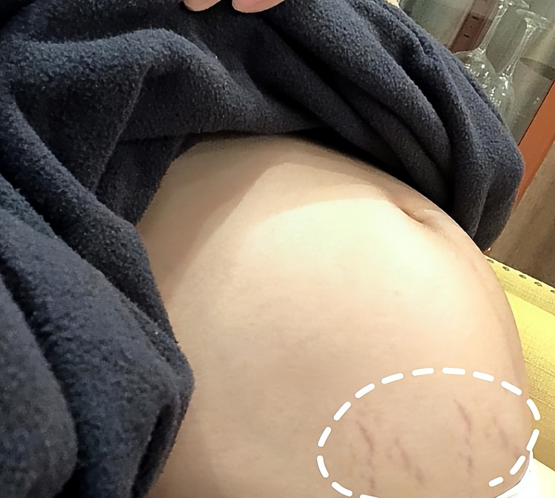 某宝销量前十的产品类型,某宝胎心仪