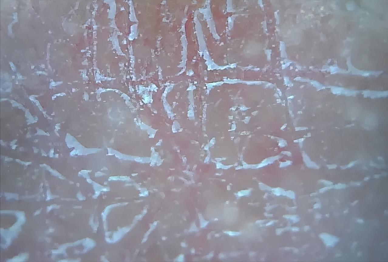 空调房待久了干燥,空调房呆久了皮肤干燥怎么办