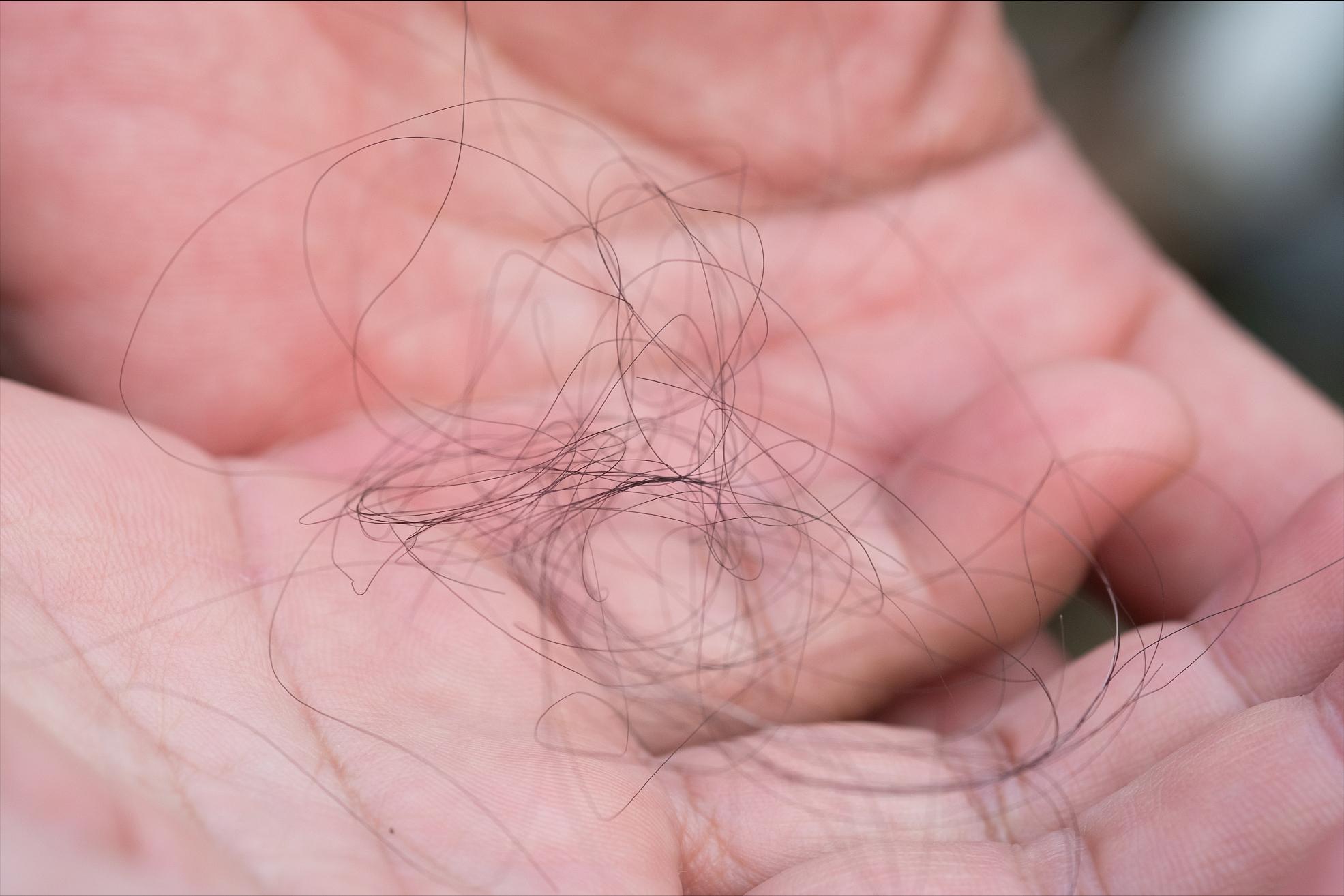 薇婷脱毛膏能脱下面的毛吗,刮完毛再用脱毛膏有用吗