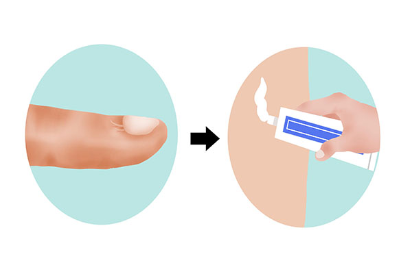 痒痒一挠就有小红疙瘩怎么回事,痒痒一挠就起一片咋回事