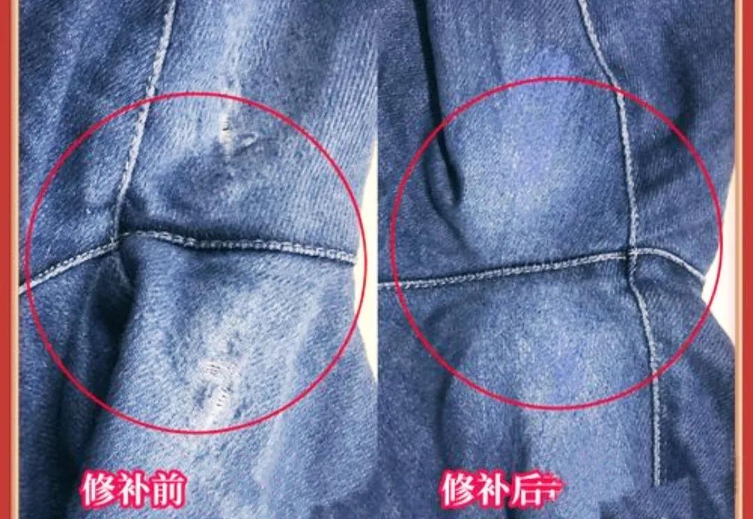 手术失败找医院索赔,手术失败了该怎么说