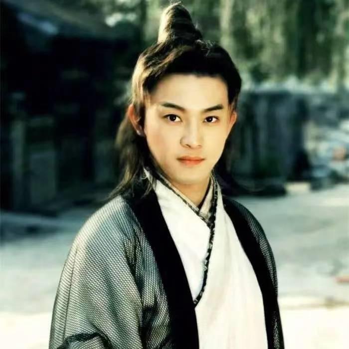 有哪些明星头发秃顶,秃顶明星发际线