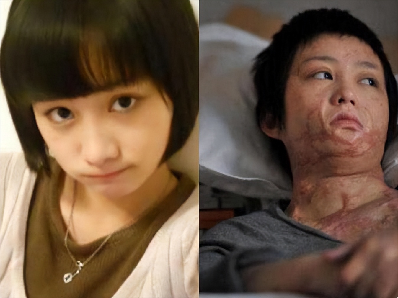 16岁女孩拒绝官二代求爱被毁容,拒绝富二代追求遭毁容以前照片