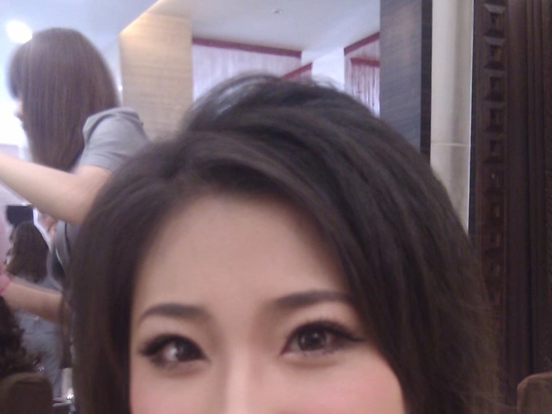 纠结要不要做飞秒,男士内双如何选择双眼皮手术