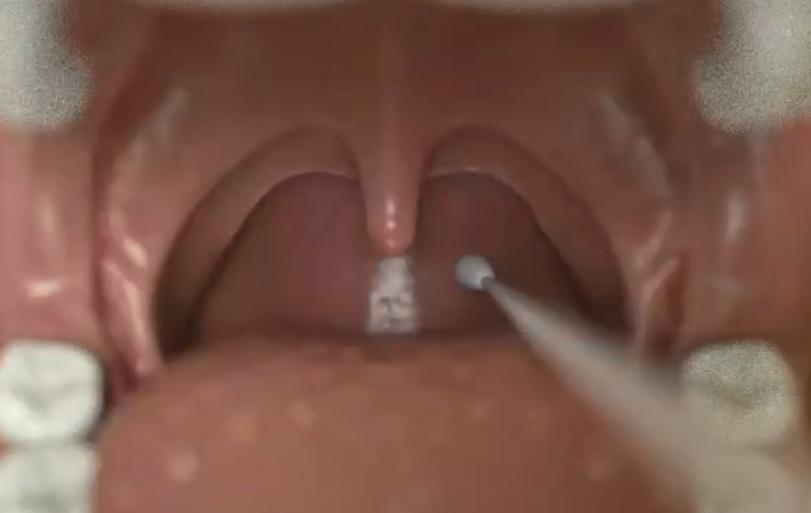 核酸检测拭子是什么材质的,核酸检测拭子怎么测