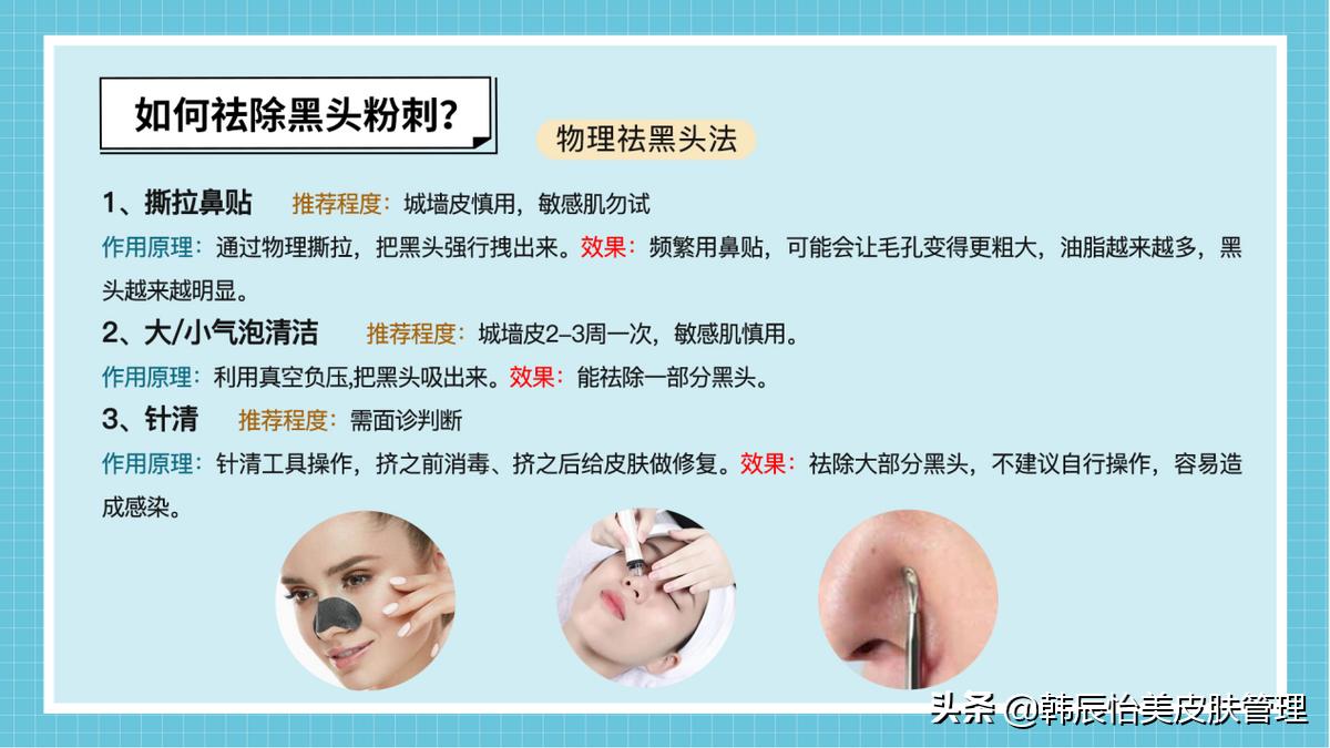 怎么能够彻底的去黑头小妙招,怎么有效的去黑头小妙招