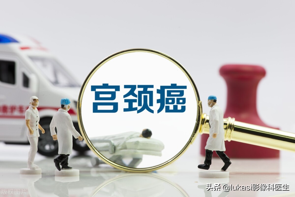 宫颈癌的可怕之处,宫颈癌日益年轻化加强筛查是重点