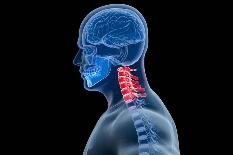 刺络拔罐联合常规针刺治疗神经根型颈椎病如何治疗?疗效如何?