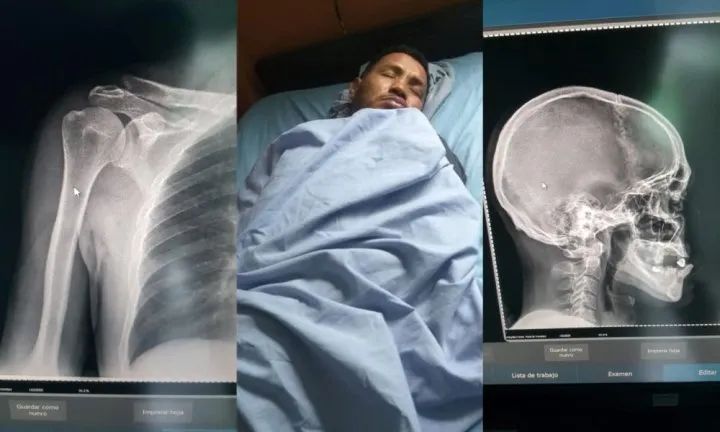 职业拳击手跟普通人打架,职业拳击手被混混打死