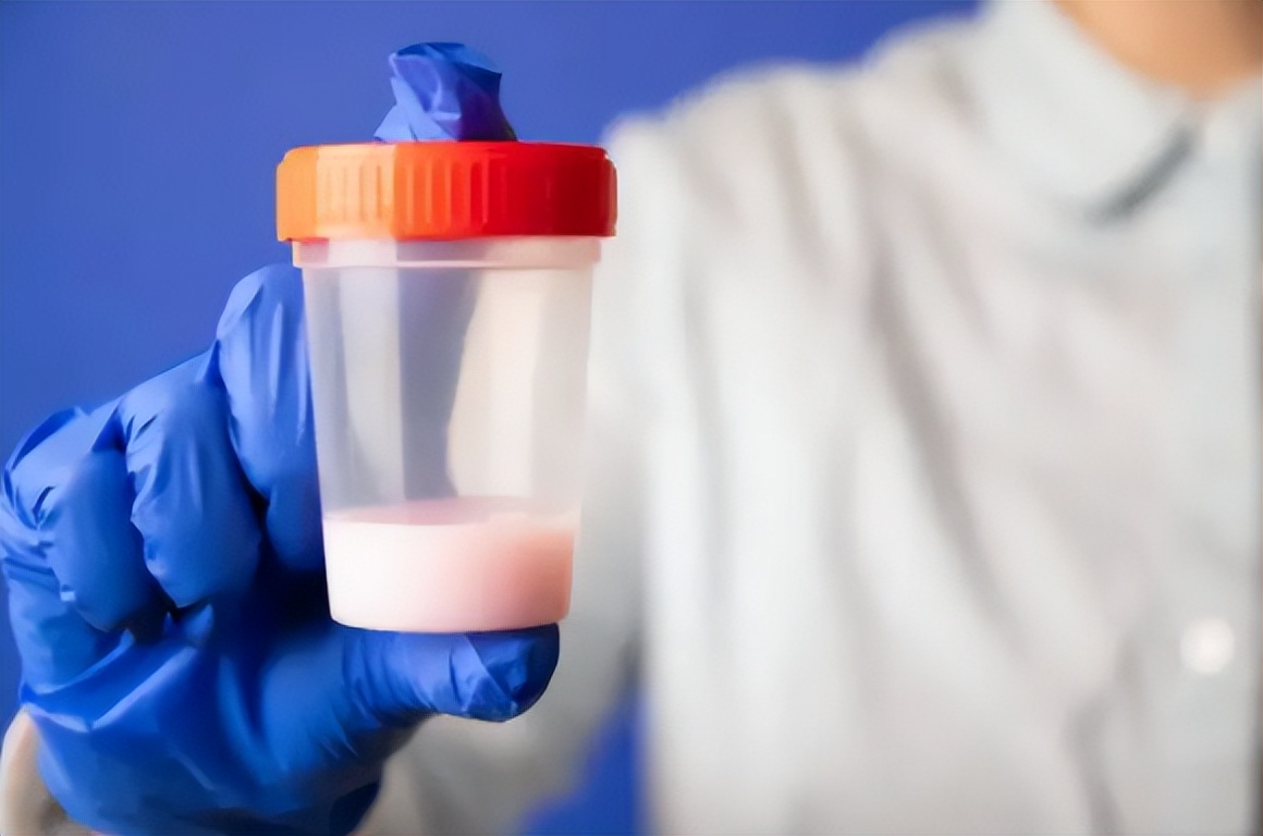 出现血精能自愈吗,出现血精能自愈吗无其他症状