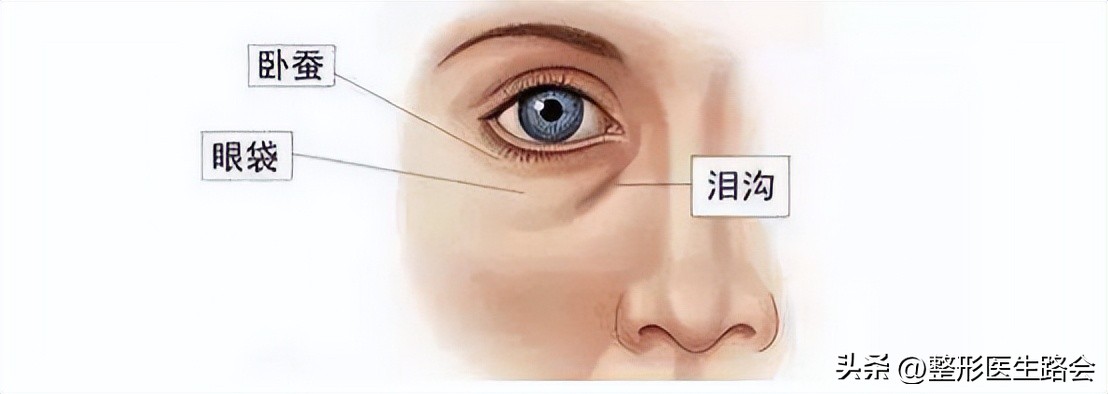 淡化泪沟有什么小技巧和方法,泪沟越来越明显是什么原因