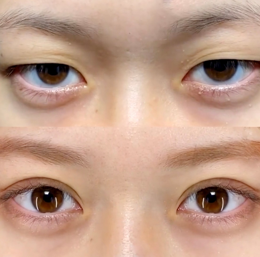 双眼皮显凶的面相,眼睛显凶相