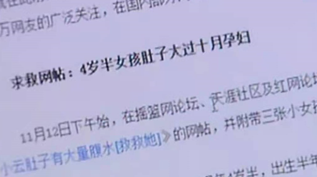 2010年一位山西4岁女童得“怪病”，肚子宽106厘米，后来治好了吗