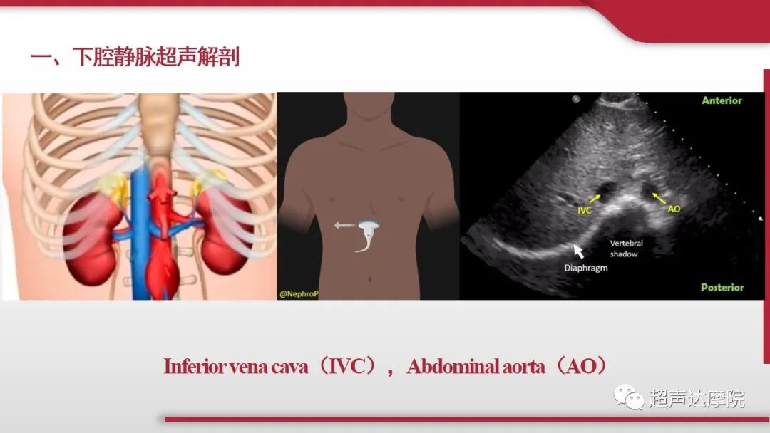 超声ppt课件大全,下腔静脉彩超评估容量