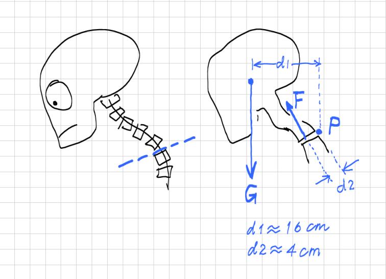 「诺总侦破日记」低头族颈椎失效模式的技术分析